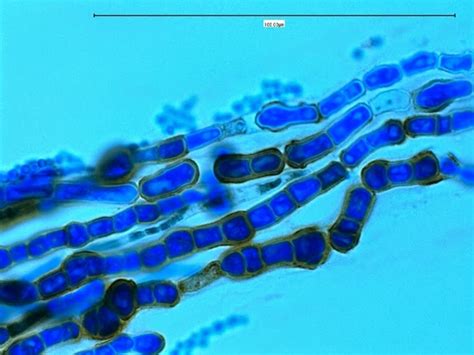Fun With Microbiology Whats Buggin You Aureobasidium Pullans