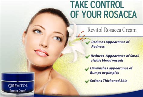 Best Rosacea Cream For Face Which Treatment To Choose In 2020