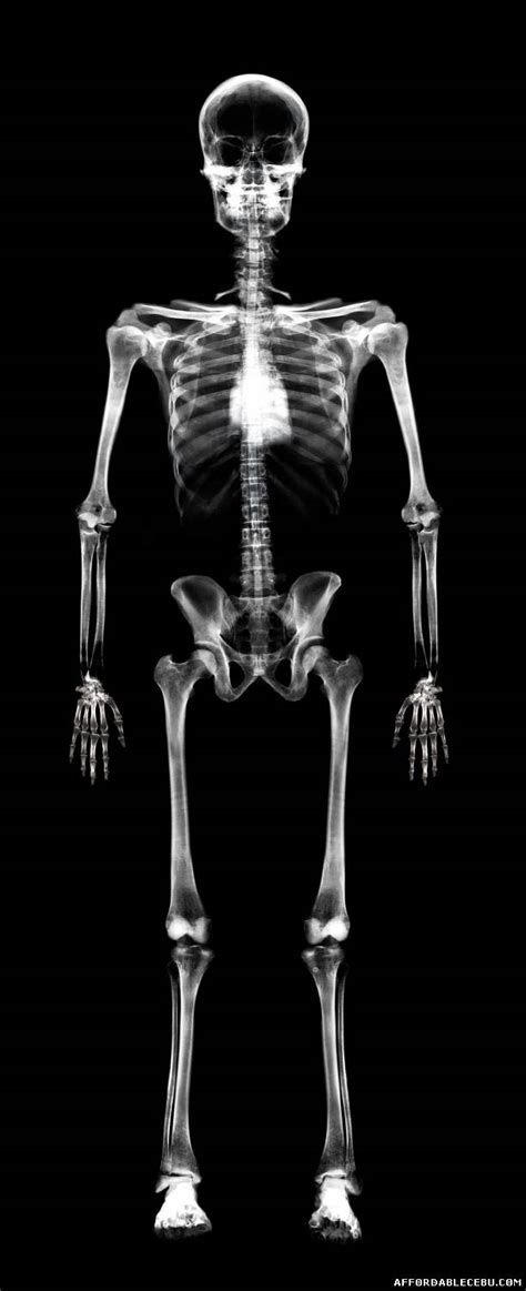 Incredible Human X Ray Pictures Photoshop Graphics 626