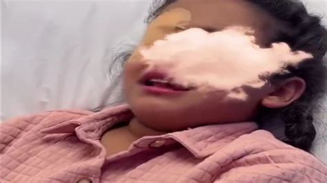 مشهد مؤثر لطفلة تعرضت لخدش خطير في عينها بسبب قطة فيديو