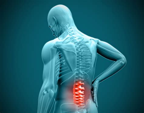 Back Pain Causes And Treatments For Osteoporosis