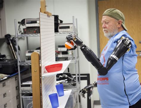Amputee Makes History Controlling Two Modular Prosthetic Limbs Brazos