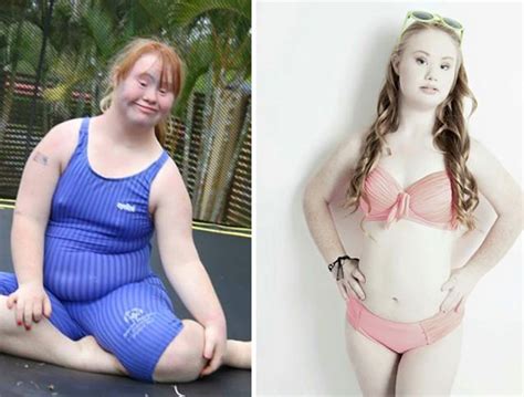 Inspirasi Gadis Down Syndrome Meraih Mimpi Menjadi Model Terkenal