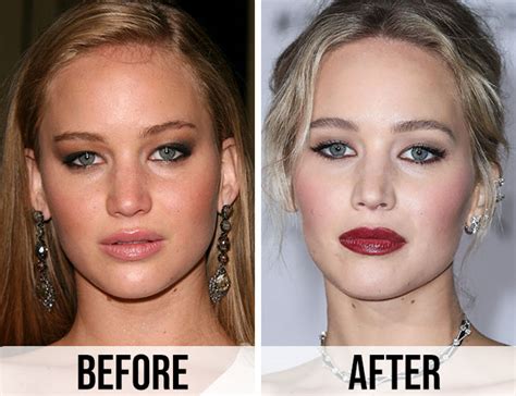 Fans Think Jennifer Lawrence Had Plastic Surgery After Seeing These Before And After Photos