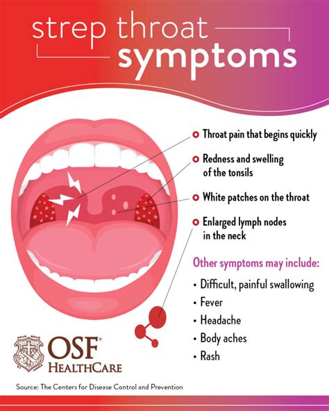 What To Know About Strep Throat Osf Healthcare