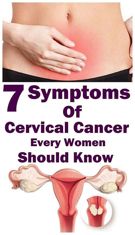 Warning Symptoms Of Cervical Cancer That Every Women Should Know Wellness Days