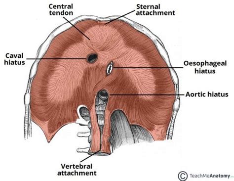 Hiatus Hernia Rolling Sliding Management TeachMeSurgery