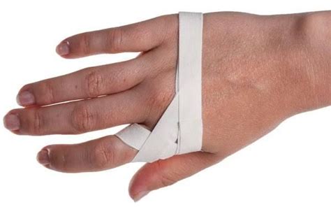 Sprained Knuckle Taping Hand Therapy Sprain Kinesiology Taping