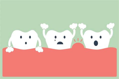 Best Periodontal Treatment Illustrations Royalty Free Vector Graphics