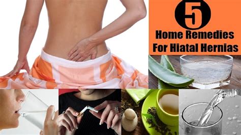 Best Hiatal Hernia Natural Treatment Options By Top Youtube