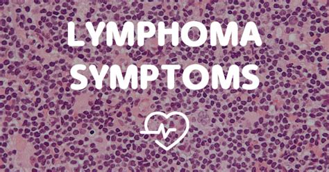 Lymphoma Symptoms All About Symptoms