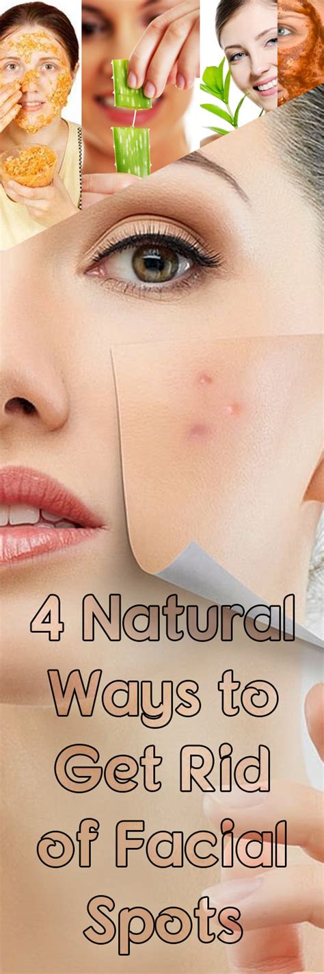 4 natural ways to get rid of facial spots