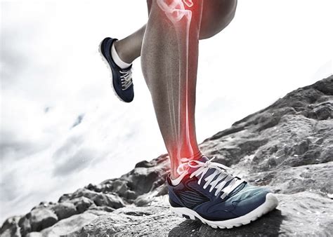 What Causes Shin Splints Unlimited Guide From 2021