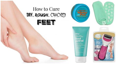 How To Cure Dry Rough Or Cracked Feet The Fashionable Housewife