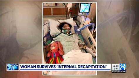 Michigan Woman Survives Internal Decapitation