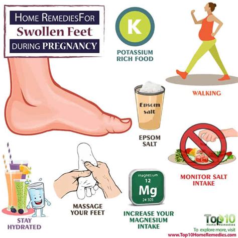 Home Remedies For Swollen Feet During Pregnancy Top 10 Home Remedies