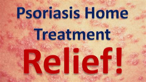 Treating Psoriasis