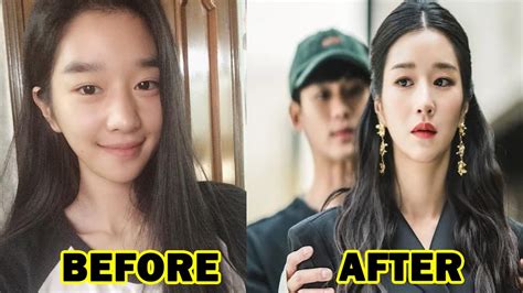 Seo Ye Ji S Plastic Surgery Is Making Rounds On The Internet