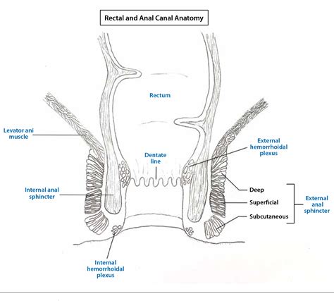 Perianal Fistulas In Patients With Crohn S Disease Part Current Medical Management