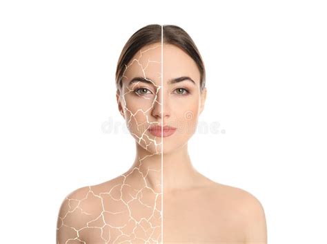 Collage With Photos Of Woman Having Dry Skin Problem Before And After