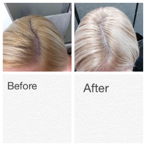 Toner will only work for hair that is already the desired lightness, but simply has hints of orange or yellow. How to fix orange roots Do 1/4 honey to 1 part apple cider ...