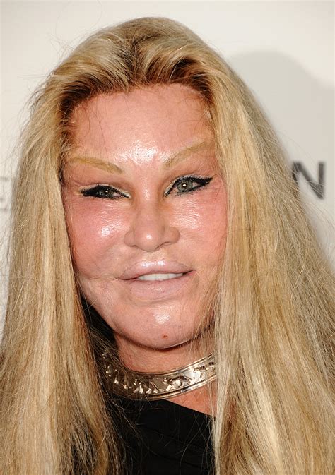 See Jocelyn Wildensteins Shocking Plastic Surgery Transformation Right Before Your Eyes Life