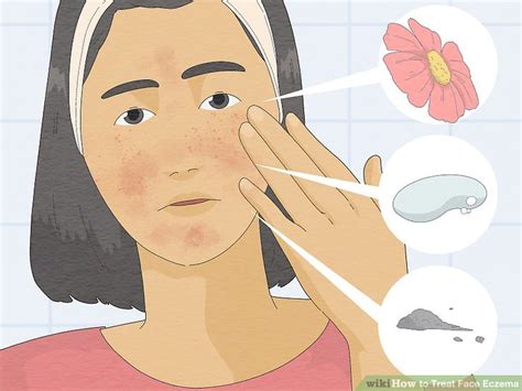 15 Ways To Treat Face Eczema Wikihow