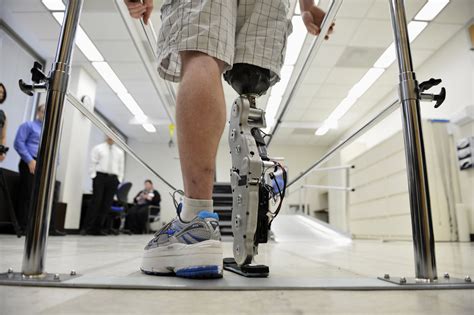 First Of Its Kind A Robotic Leg That Is Controlled By Thoughts