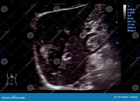 Colourful Image Of Modern Ultrasound Monitor Stock Image Image Of