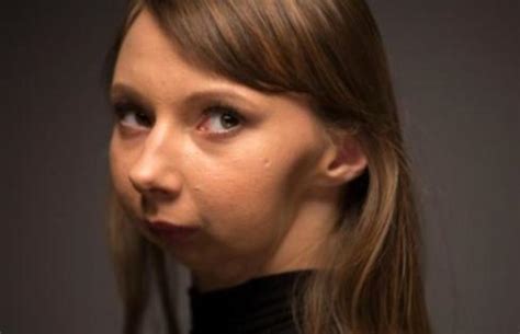 How Lives The Girl Without Lower Jaw An Amazing Story