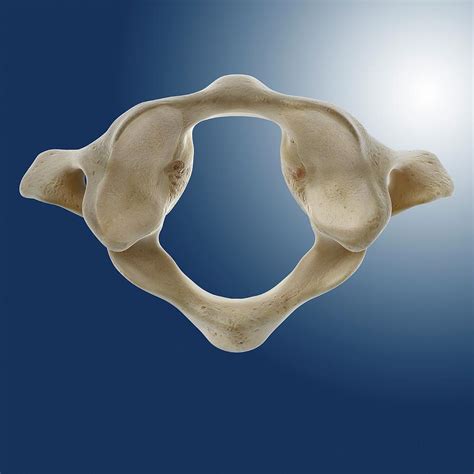 The anterior arch, the lateral masses, and the posterior arch. Atlas Vertebra (c1) Photograph by Springer Medizin