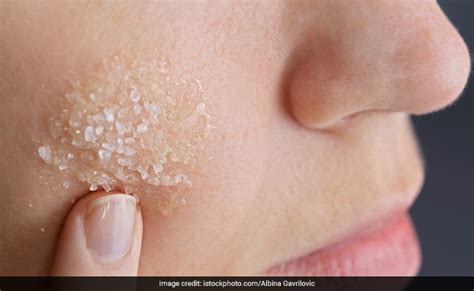 How To Remove Dead Skin From Face Home Remedies Try These 5 Kitchen Ingredients Natural Scrub