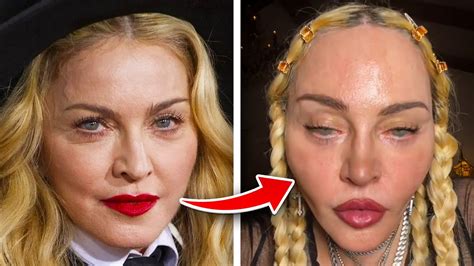 What Happened To Madonnas Face Youtube