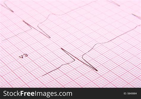 Close Up Of Ecg Graph Free Stock Images Photos 5840684