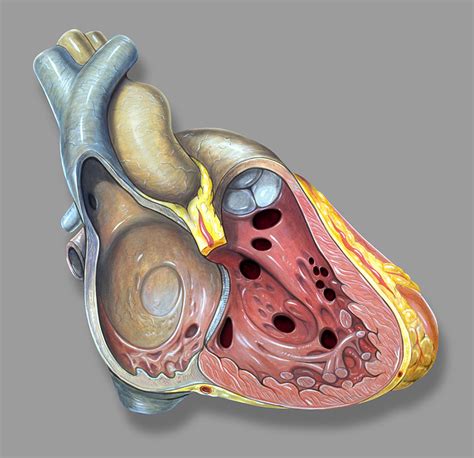 Pediatric Ventricular Septal Defect VSD Diagnosis And Treatment