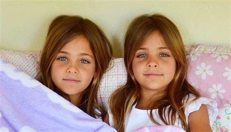 Irmãs Consideradas “as Gêmeas Mais Lindas Do Mundo” Cresceram E Hoje