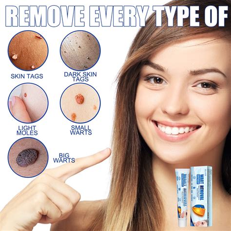 Eelhoe Warts Remover Original Cream Skin Tag Remover Original Warts