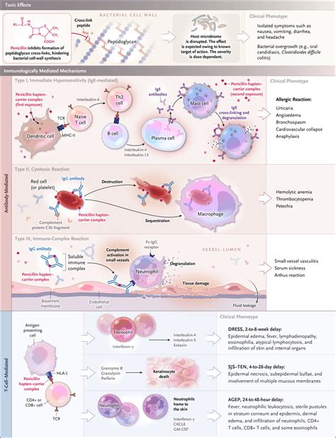 Penicillin Allergy Nejm