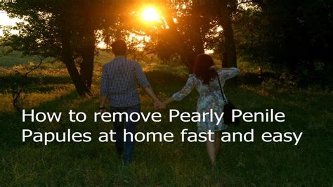 Remove Pearly Penile Papules On The Shaft At Home Pearly Penile Papules