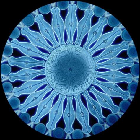 Diatoms In The Ocean Darkfield Image Of A Diatom Exhibition Slide