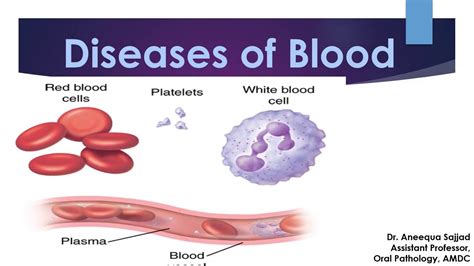 Lecture On Diseases Of Blood Part 1 Youtube