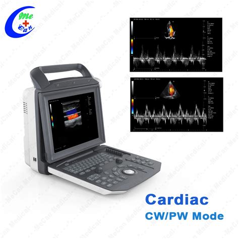 Full Digital Portable Mobile Echocardiography Cardiac Echo Ultrasound