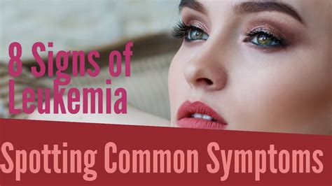 How To Recognize The Signs Of Leukemia Spotting Common Symptoms Youtube
