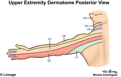 Dermatomes Upper Limb