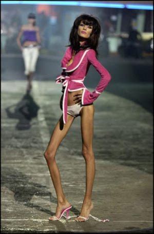 Anorexic Girls Damn Cool Pictures