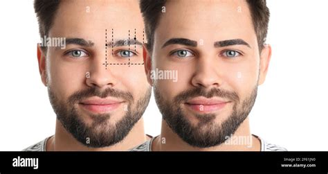 Tinte De Barba Cejas Antes Y Despues