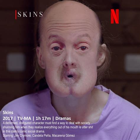 Skins On Netflix When You Have An Asshole For A Mouth And Every Word