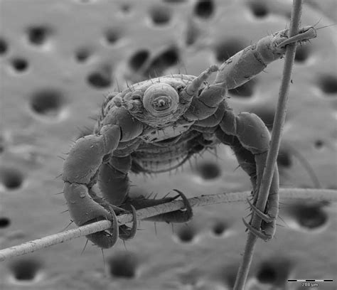 Psbattle Lice Under Electron Microscope Rphotoshopbattles