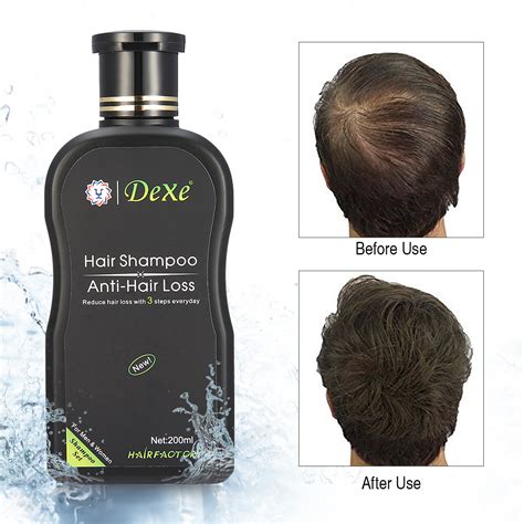 Dexe Natural Ingredients Anti Hair Loss Hair Growth Shampoo Treatment