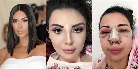 See Woman Who Spent ₦180m On Surgery To Look Like Kim Kardashian
